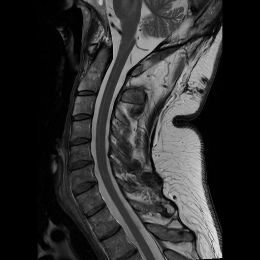 MRI slice 8